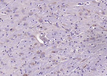 LIFR Rabbit Polyclonal Antibody
