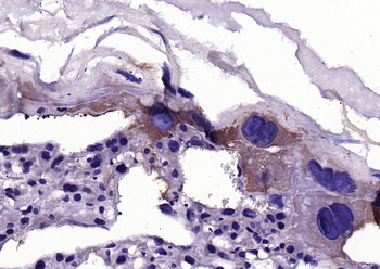 LIFR Rabbit Polyclonal Antibody