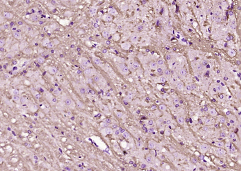 LINGO1 Rabbit Polyclonal Antibody