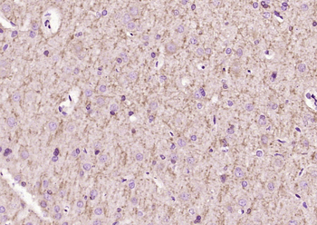 LINGO1 Rabbit Polyclonal Antibody