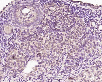 LIS1 Rabbit Polyclonal Antibody