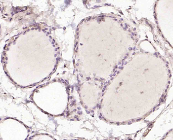 LIS1 Rabbit Polyclonal Antibody