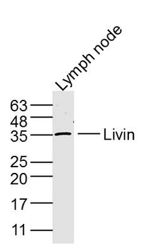 Livin Rabbit Polyclonal Antibody