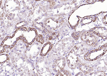 Liver FABP Rabbit Polyclonal Antibody