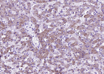 Liver FABP Rabbit Polyclonal Antibody
