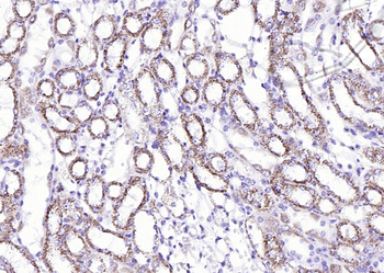 Liver FABP Rabbit Polyclonal Antibody
