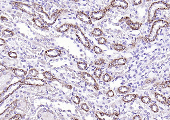 Liver FABP Rabbit Polyclonal Antibody