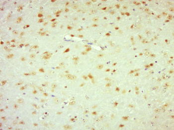 Laminin subunit beta-1 Rabbit Polyclonal Antibody