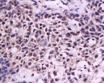 Laminin subunit beta-1 Rabbit Polyclonal Antibody