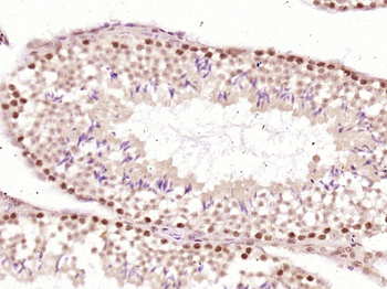 Lpin1 protein Rabbit Polyclonal Antibody