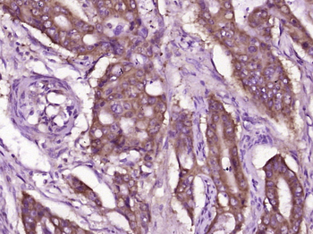 LRP/MVP Rabbit Polyclonal Antibody