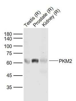 PKM2 Rabbit Polyclonal Antibody