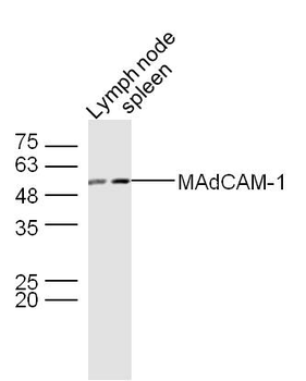 MAdCAM-1 Rabbit Polyclonal Antibody