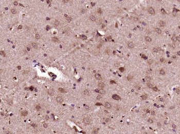 MEK1 + MEK2 Rabbit Polyclonal Antibody