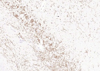 MBP Rabbit Polyclonal Antibody