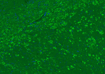 MBP Rabbit Polyclonal Antibody