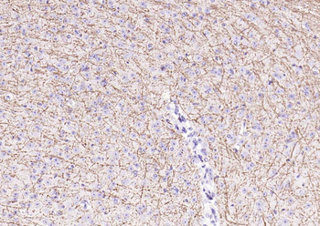 MBP Rabbit Polyclonal Antibody
