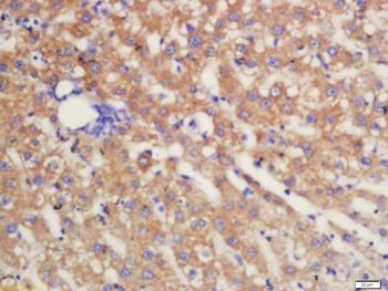 MDR1/P Glycoprotein Rabbit Polyclonal Antibody