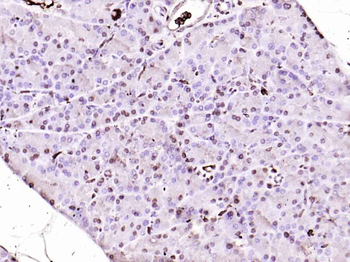 MT2A Rabbit Polyclonal Antibody