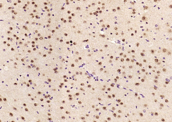 MTA1 Rabbit Polyclonal Antibody