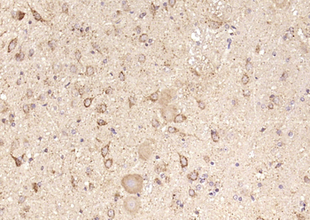 MTA1 Rabbit Polyclonal Antibody