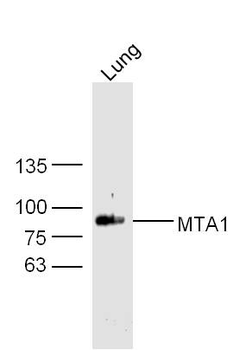 MTA1 Rabbit Polyclonal Antibody