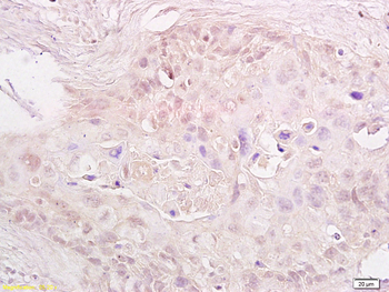 MTA1 Rabbit Polyclonal Antibody