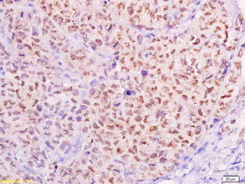 MTA1 Rabbit Polyclonal Antibody