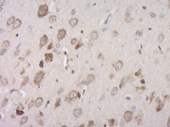 CCL4 Rabbit Polyclonal Antibody