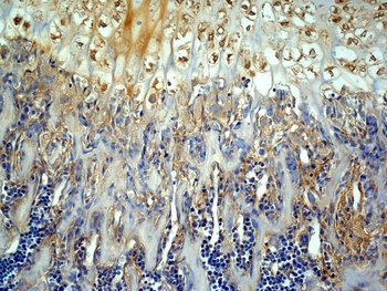 MMP13 Rabbit Polyclonal Antibody