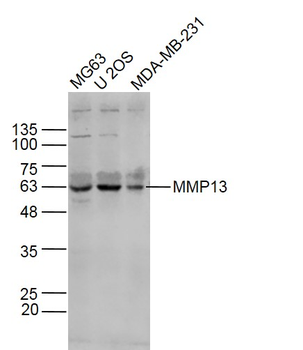 MMP13 Rabbit Polyclonal Antibody