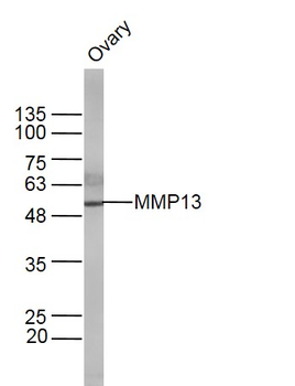 MMP13 Rabbit Polyclonal Antibody