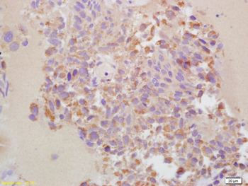 MMP13 Rabbit Polyclonal Antibody