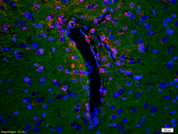 MMP14 Rabbit Polyclonal Antibody