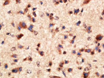 MMP2 Rabbit Polyclonal Antibody