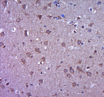 MMP2 Rabbit Polyclonal Antibody
