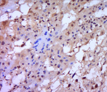 MMP2 Rabbit Polyclonal Antibody