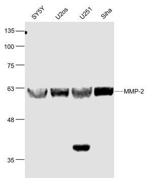 MMP2 Rabbit Polyclonal Antibody