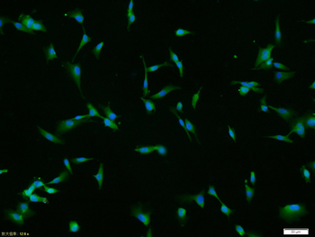MMP2 Rabbit Polyclonal Antibody