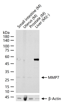 MMP7 Rabbit Polyclonal Antibody