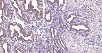 MMP7 Rabbit Polyclonal Antibody