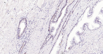 MMP7 Rabbit Polyclonal Antibody