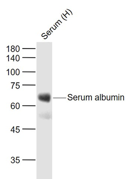 Human Serum albumin Mouse Monoclonal Antibody (Loading Control)