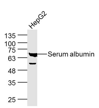 Human Serum albumin Rabbit Polyclonal Antibody (Loading Control)