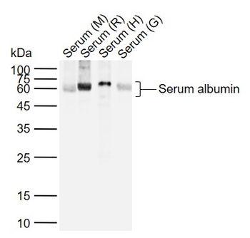 Human Serum albumin Rabbit Polyclonal Antibody (Loading Control)