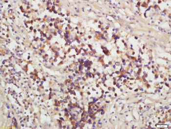 MRP1/ABCC1 Rabbit Polyclonal Antibody