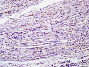 MyD88 Rabbit Polyclonal Antibody