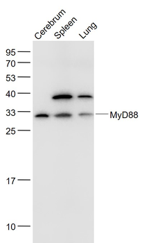 MyD88 Rabbit Polyclonal Antibody