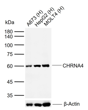 CHRNA4 Rabbit Polyclonal Antibody