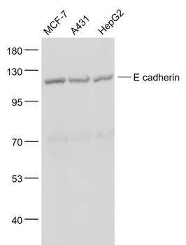 E cadherin Rabbit Polyclonal Antibody